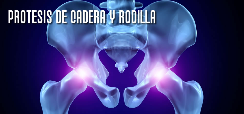 Prótesis de Cadera y Rodilla