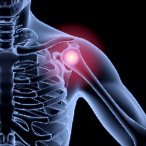 Ortopedista en San Mateo Atenco