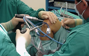 Artroscopía de Rodilla en Toluca