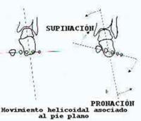 Tratamiento del Pie Plano en Toluca